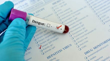 Cara Alami Mengobati Demam Berdarah Test Dengue
